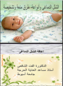 تحميل كتاب اعاقة الشلل الدماغى PDF للمؤلف د. ألفت الشافعى مجانا